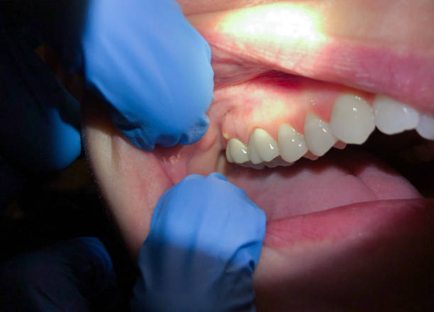 Best Emergency Dental Care for Trauma or Injury in Deans, NJ